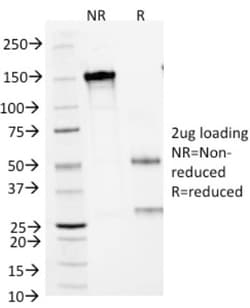 Lung Cancer Marker Antibody (MOC-52), Novus Biologicals:Antibodies:Primary